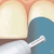 Материалы для полировки зубов и пломб